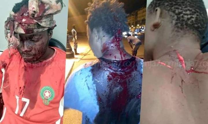 اعتداء عنصري بطنجة على مهاجرين أفارقة تخلف اصابات بليغة 4 اعتداء عنصري بطنجة على مهاجرين أفارقة تخلف اصابات بليغة