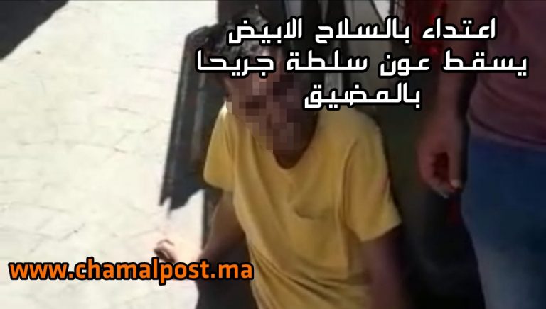 تعرض عون سلطة بالمضيق لاعتداء خلال عملية تحرير الملك العمومي 8 تعرض عون سلطة بالمضيق لاعتداء خلال عملية تحرير الملك العمومي
