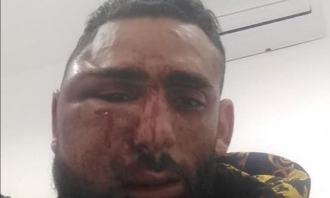 ولاية أمن تطوان تنفي اتهامات بالضغط على شاب لسحب شكايته 3 ولاية أمن تطوان تنفي اتهامات بالضغط على شاب لسحب شكايته