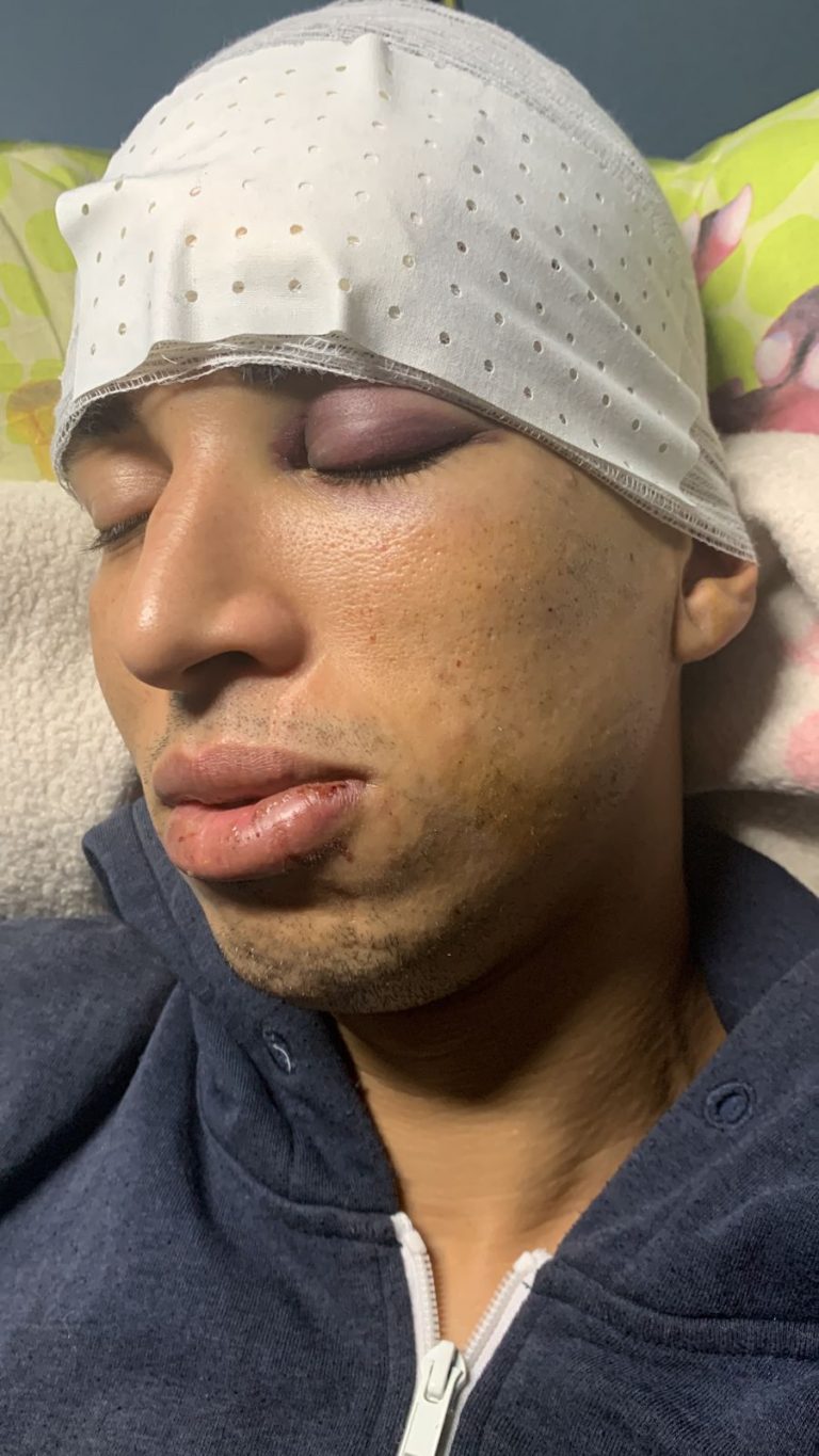 طنجة..عصابة كادت أن تنهي حياة شاب في مقتبل العمر لهذه الأسباب