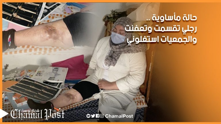 “حالة مأساوية : “رجلي تعفنت والضمان الاجتماعي سرقوهلي والجمعيات استغلوني