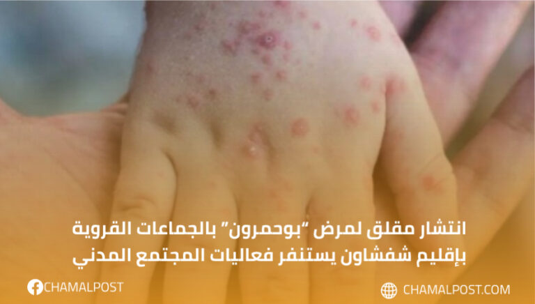 انتشار مقلق لمرض “بوحمرون” بالجماعات القروية بإقليم شفشاون يستنفر فعاليات المجتمع المدني