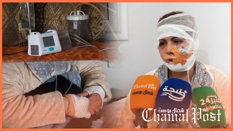 طليق يحاول قت_ل طليقته.. والضحية تنجو بأعجوبة